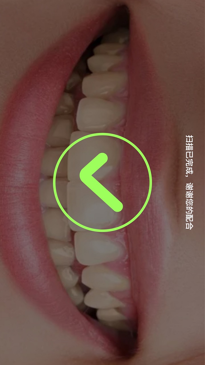 贝壳齿思