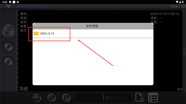 智能b超app