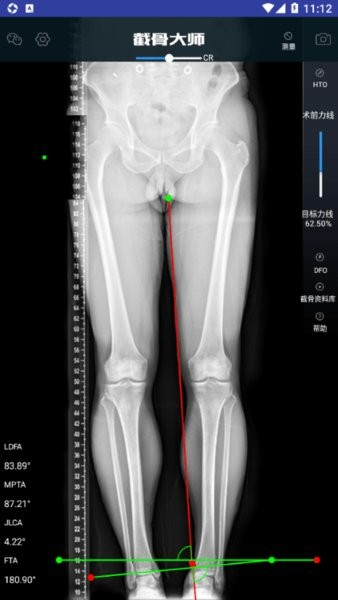 截骨大师